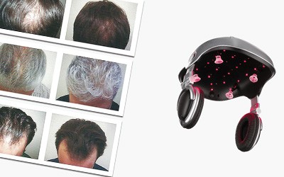 Aparelho inovador para combater a calvície e enfraquecimento do cabelo chega a Portugal